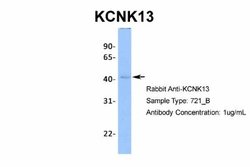 KCNK13 Antibody, Novus Biologicals 100 &mu;L; Unconjugated:Antibodies,